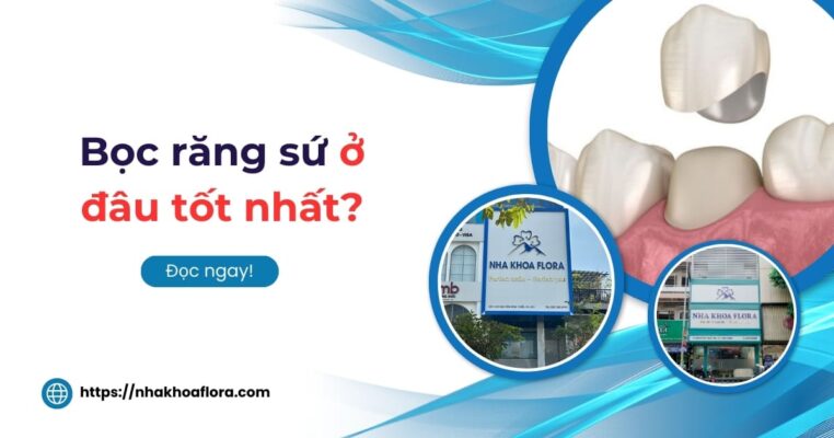 bọc răng sứ ở đâu tốt nhất