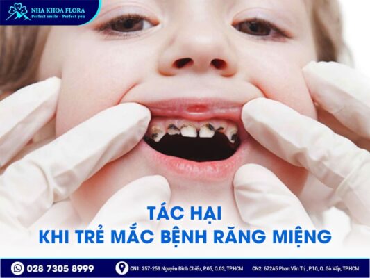 chăm sóc răng miệng cho trẻ - ảnh 2