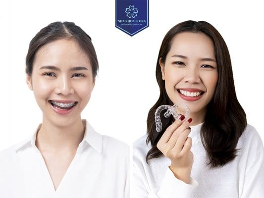 TOP 10 DENTISTRY IN HO CHI MINH CITY HCM HAS GOOD BRACES SERVICE 1