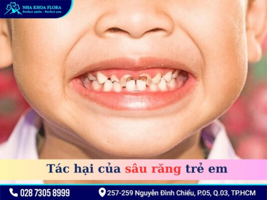 Thói quen xấu gây sâu răng ở trẻ - ảnh 1