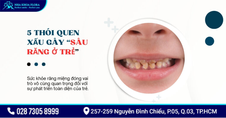 Thói quen xấu gây sâu răng ở trẻ