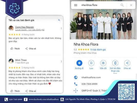 REVIEW NHA KHOA CHỮA CƯỜI HỞ LỢI QUA CÁC TRẢI NGHIỆM THỰC TẾ 2