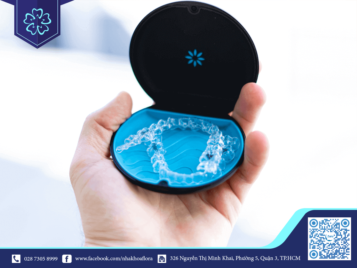 Niềng trong suốt