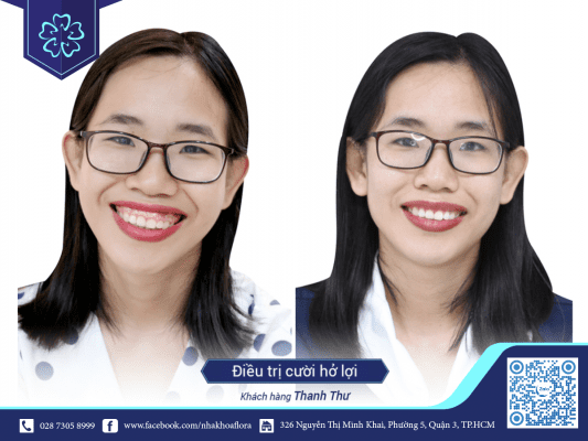 THE TERM "LAUGHTER" IN DENTISTRY 2