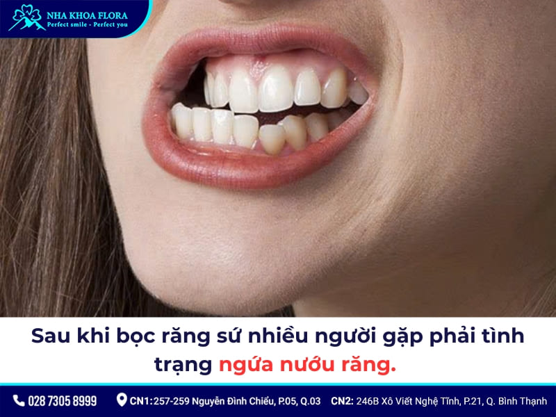 biểu hiện sau khi bọc răng sứ