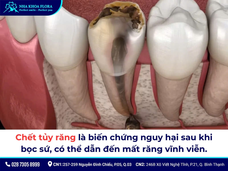 biểu hiện sau khi bọc răng sứ