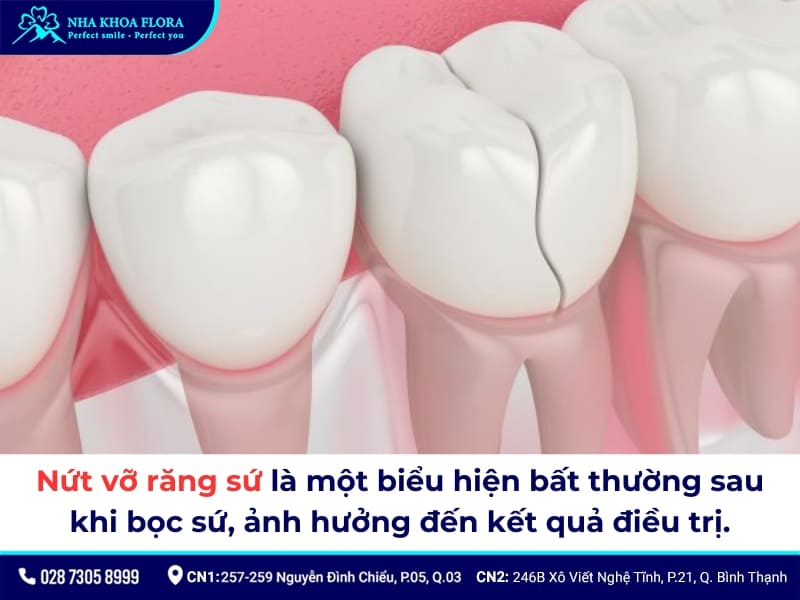 biểu hiện sau khi bọc răng sứ