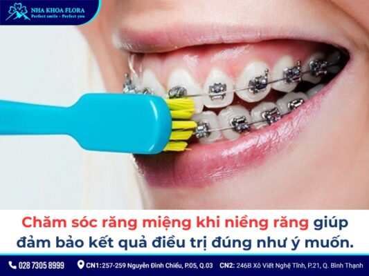 cách chăm sóc răng miệng khi niềng răng - ảnh 1