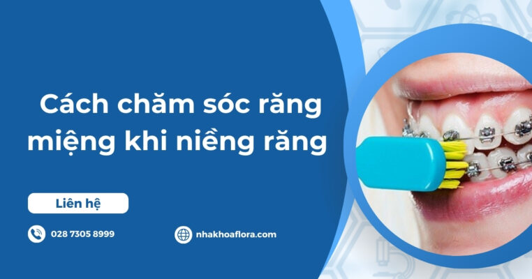 cách chăm sóc răng miệng khi niềng răng