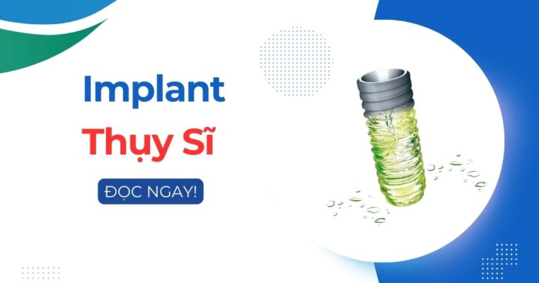 implant thụy sỹ
