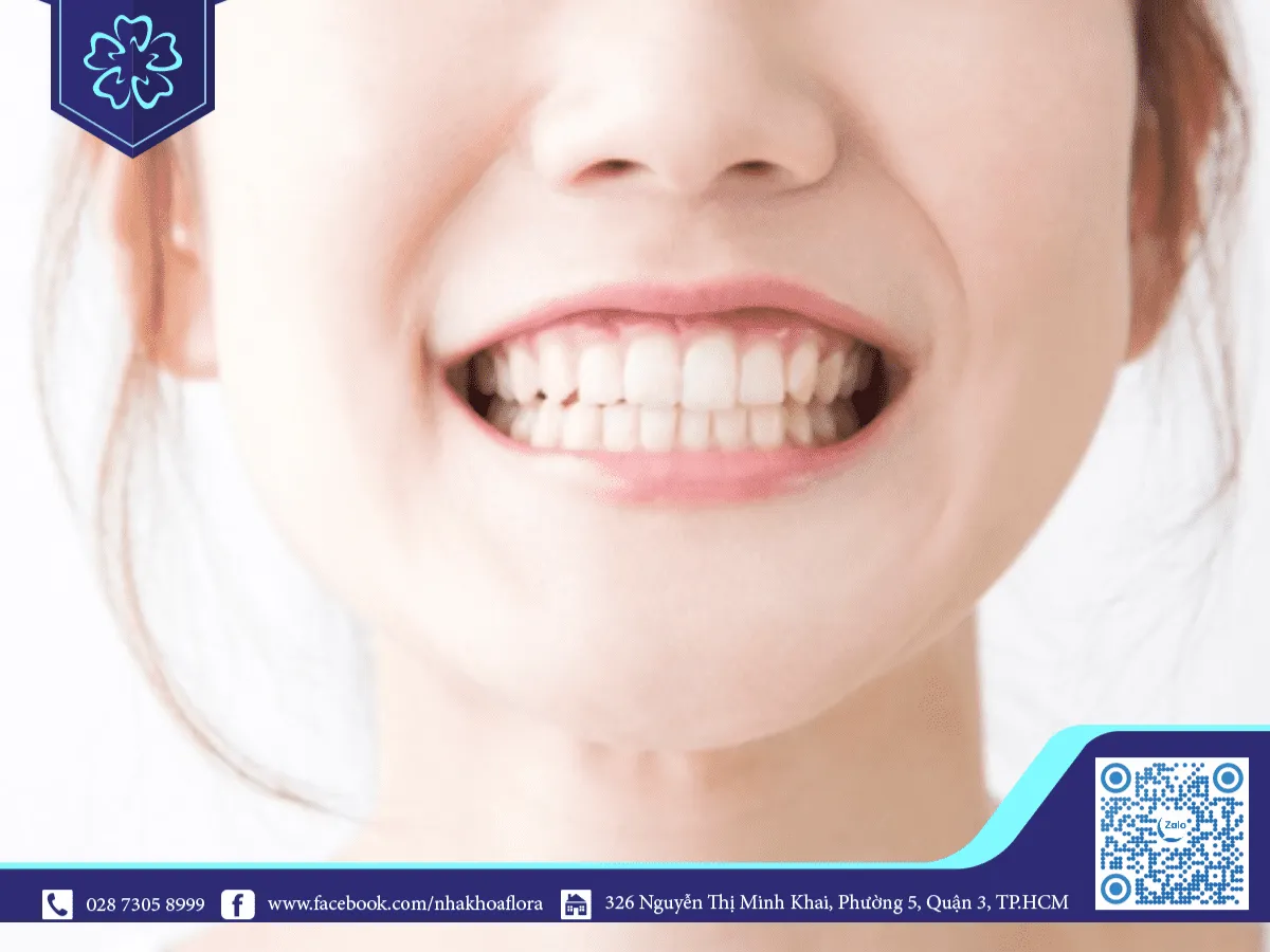 Trị cười hở lợi tại nhà là điều không thể