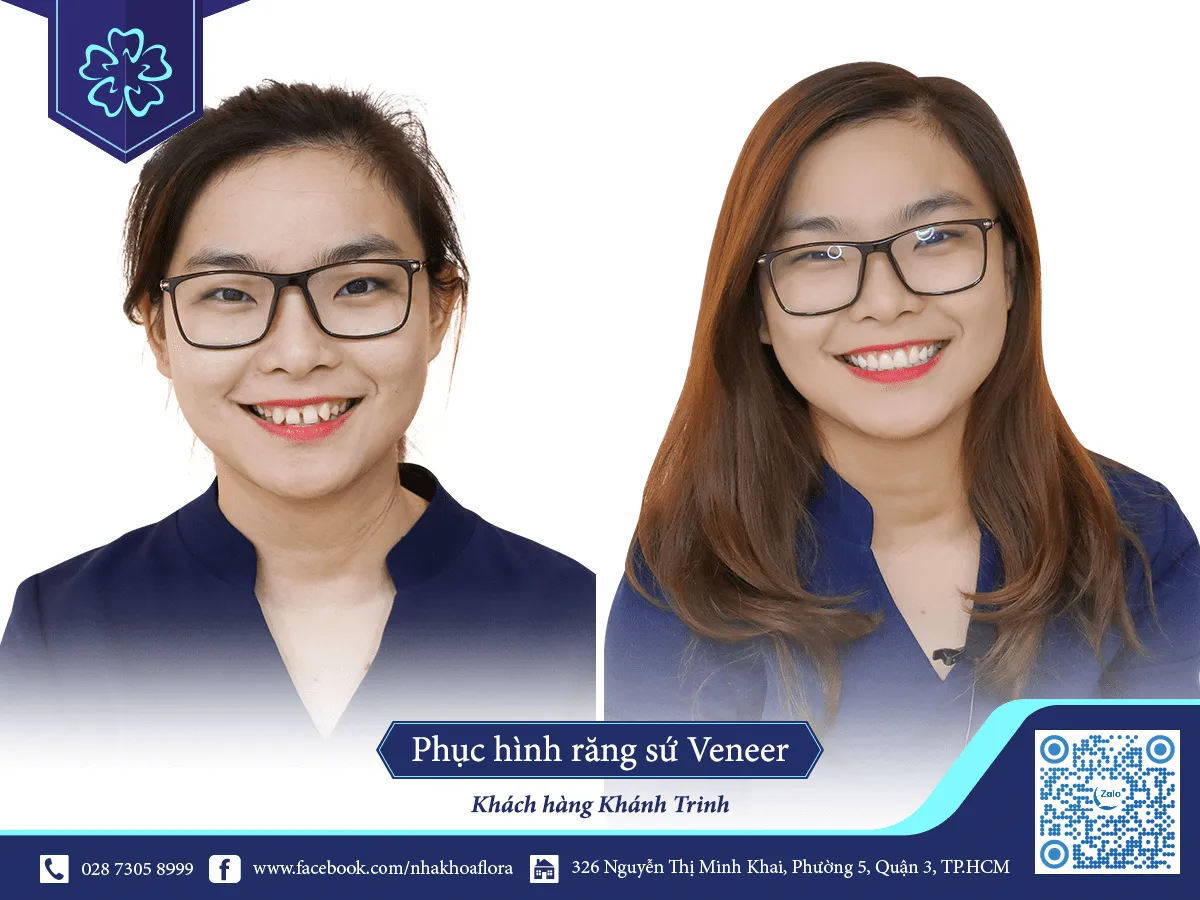 PORCELAIN TEETH-WRAPPED CUSTOMERS