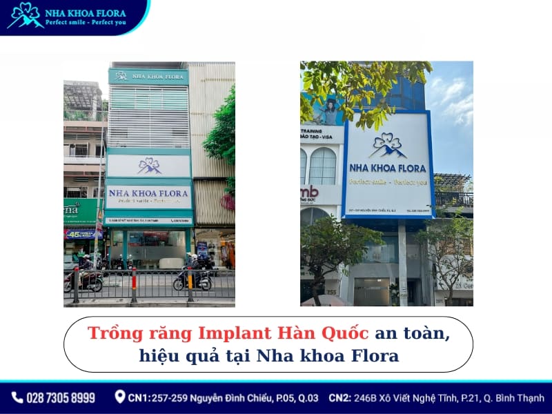 trụ implant hàn quốc