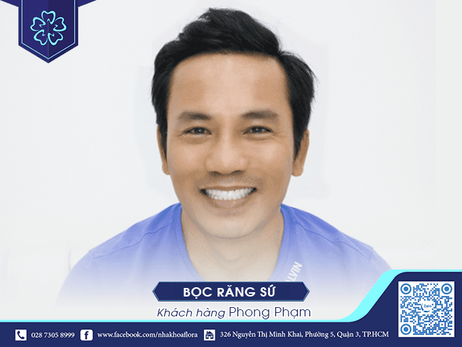 khách hàng sau bọc răng sứ