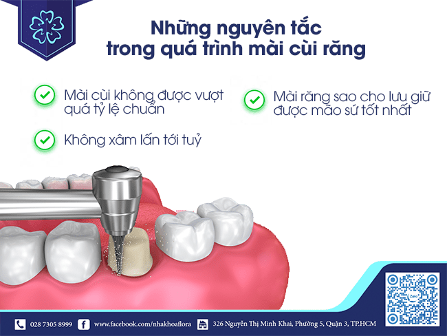 nguyên tắc mài răng bọc răng sứ