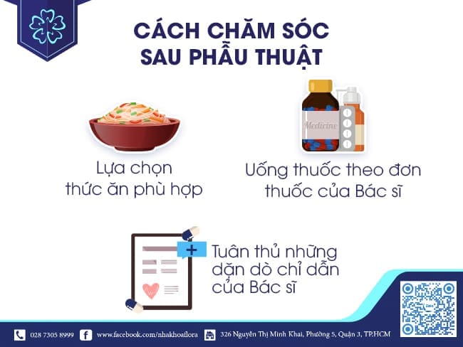 chăm sóc sau tiểu phẫu cười hở lợi
