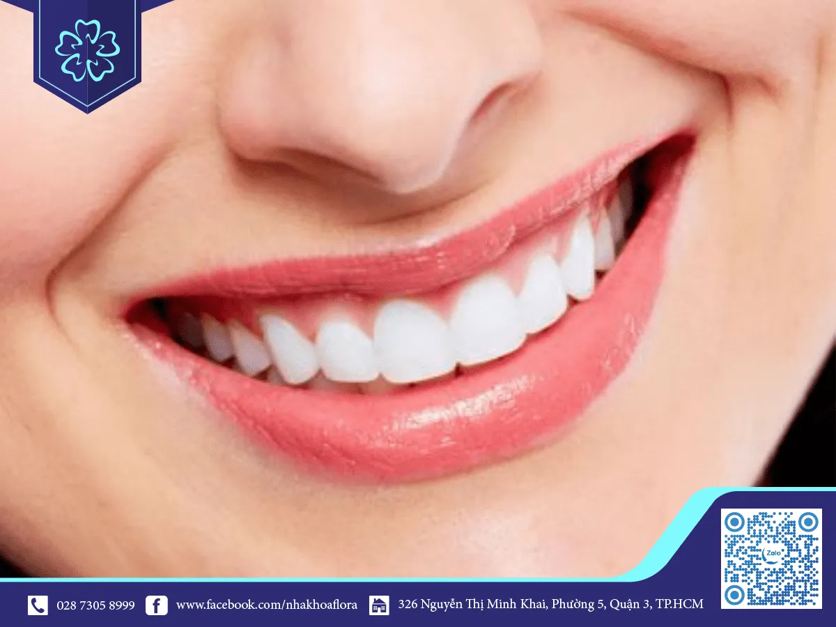 beautiful porcelain teeth