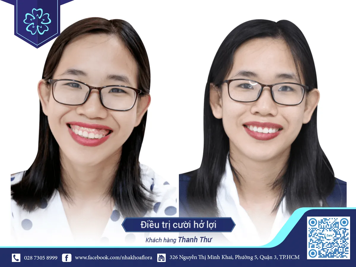 Customers after the treatment laughed.