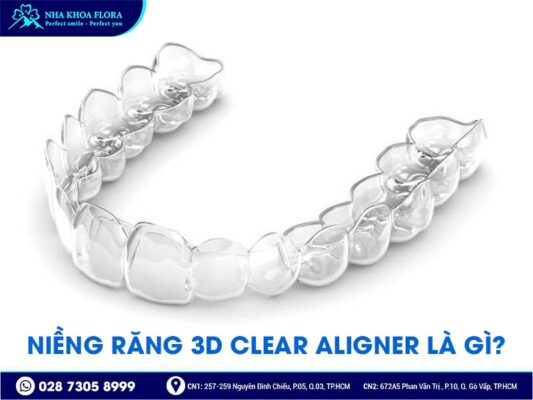 niềng răng 3d clear - ảnh 1