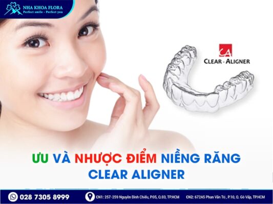 niềng răng 3d clear - ảnh 3