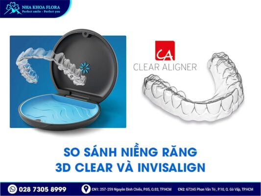 niềng răng 3d clear - ảnh 4