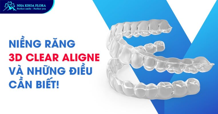 niềng răng 3d clear