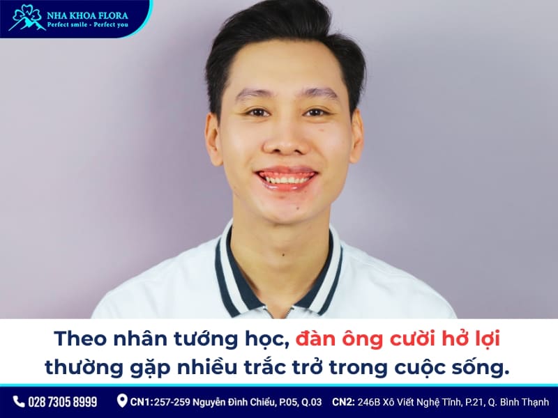 cười hở lợi tướng số đàn ông