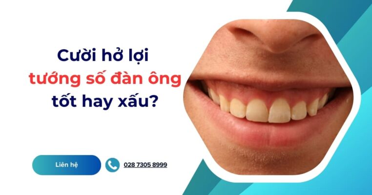 cười hở lợi tướng số đàn ông