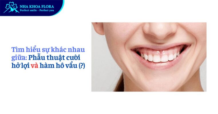 cười hở lợi và hàm hô vẩu