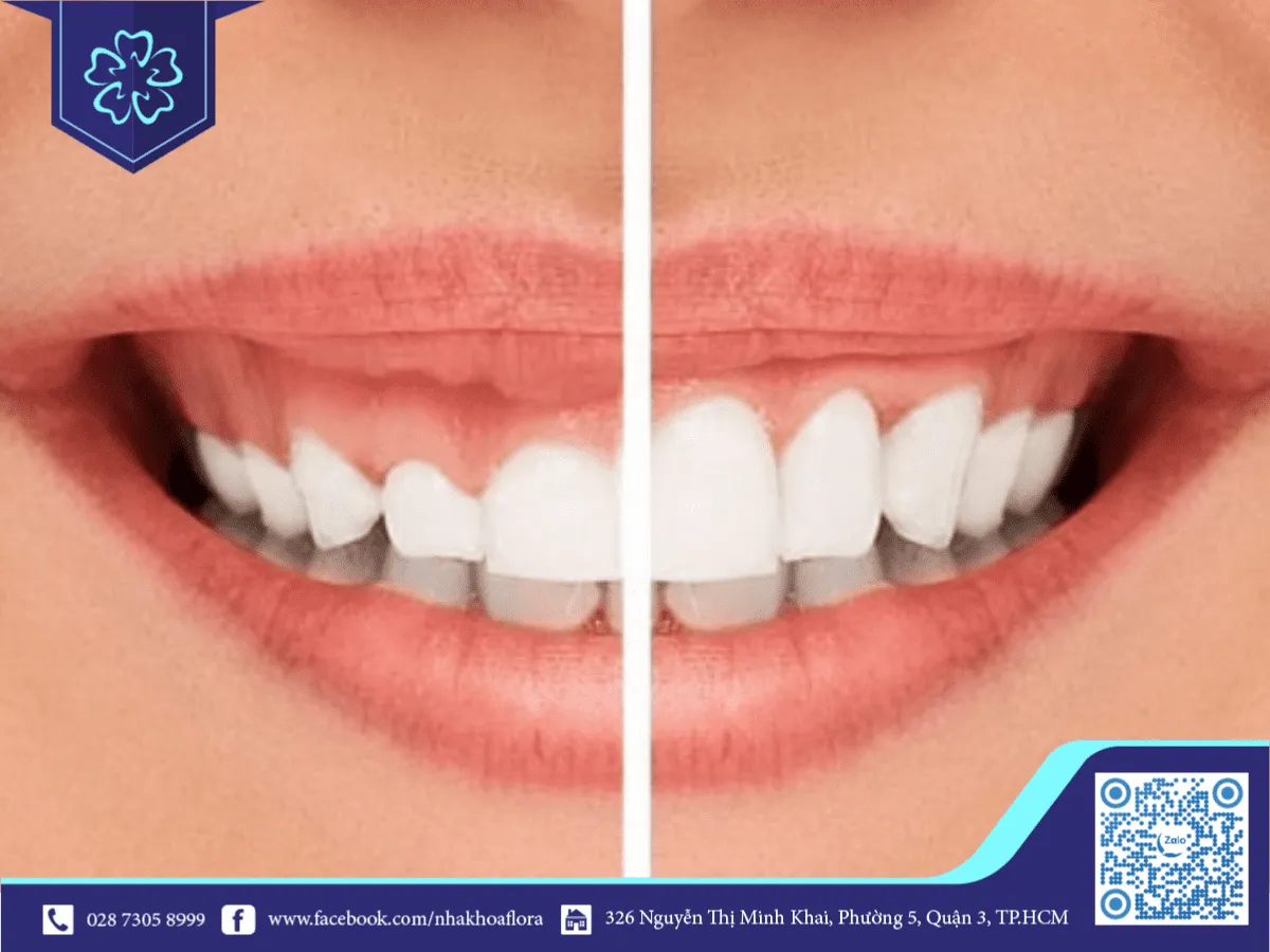 before and after the treatment, laughter is good.