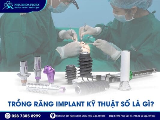 trồng răng implant kỹ thuật số - ảnh 1