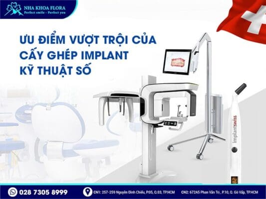 trồng răng implant kỹ thuật số - ảnh 2