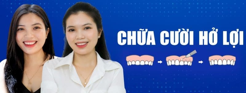 TOP INDUSTRIES THAT ARE BADLY AFFECTED WHEN "LIVING TOGETHER" WITH AN OPEN SMILE? 1