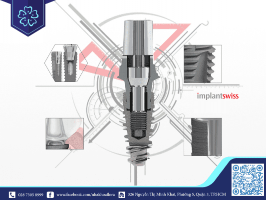 Không nên cấy ghép implant giá rẻ