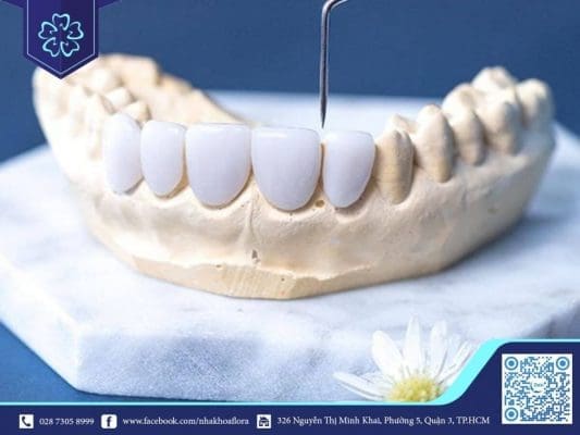 Venus porcelain teeth