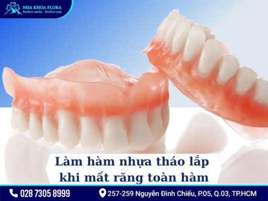 Phương pháp điều trị mất răng - ảnh 5