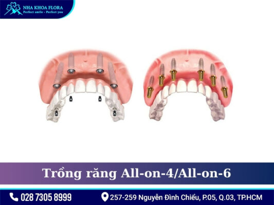 Phương pháp điều trị mất răng - ảnh 7