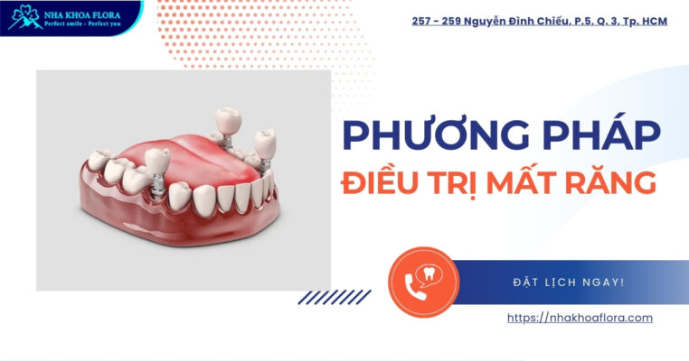 Phương pháp điều trị mất răng