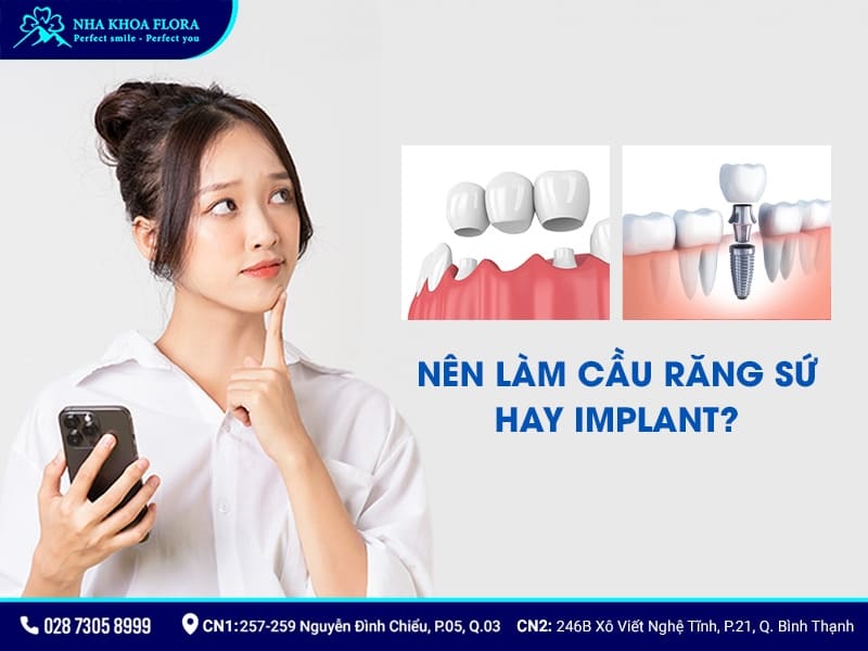 cầu răng sứ hay implant