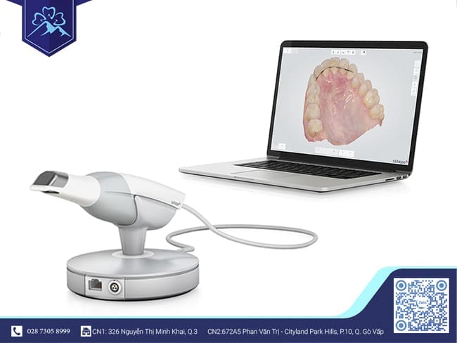 TRIOS MACHINE - FLORA DENTAL OFFERS DIGITAL RESTORES 1