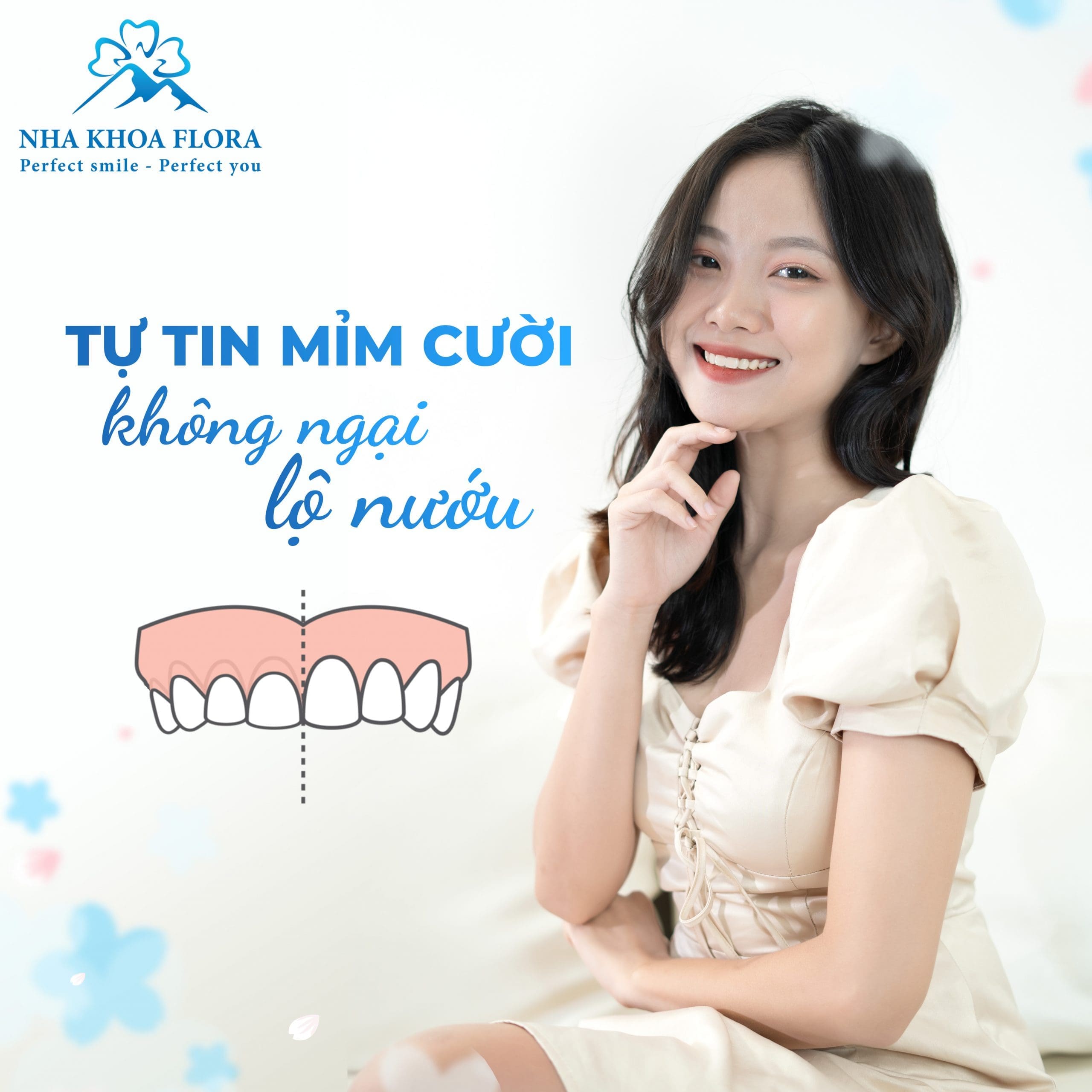 Loại bỏ nỗi lo "cười hở lợi là khổ" cùng Nha Khoa Flora