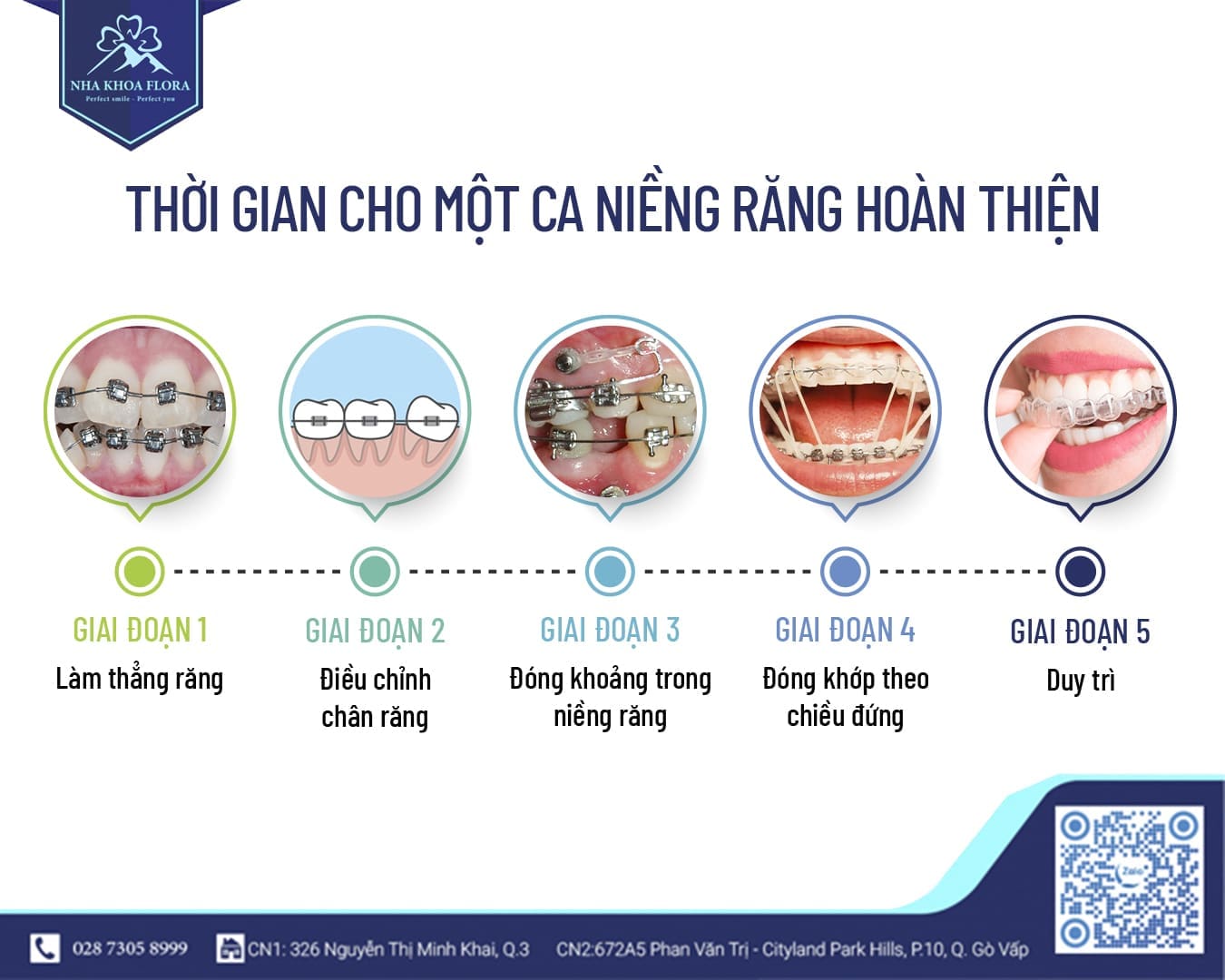 Các giai đoạn của 1 ca niềng răng mắc cài