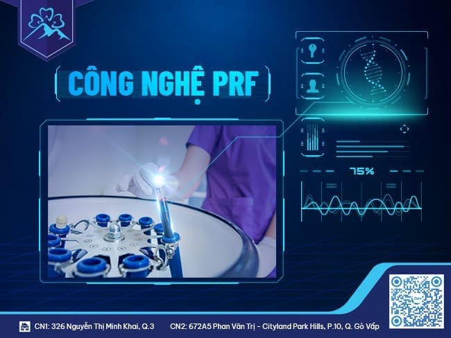 Ứng dụng công nghệ PRF trong nhổ răng khôn - ảnh 3