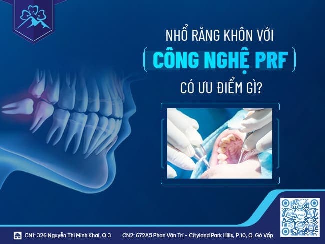 Ứng dụng công nghệ PRF trong nhổ răng khôn - ảnh 4