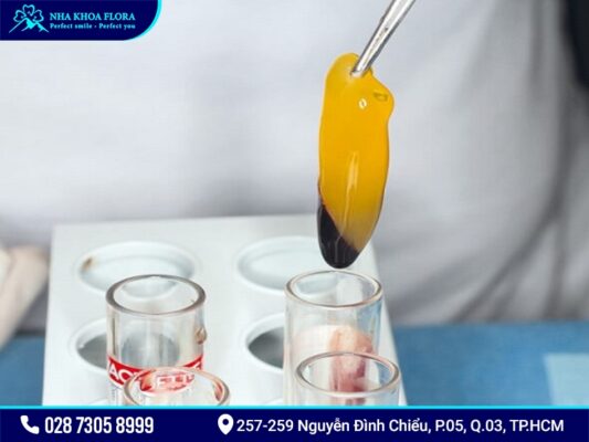 Công nghệ màng PRF - ảnh 1