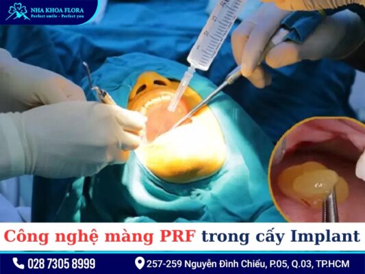 Công nghệ màng PRF - ảnh 2