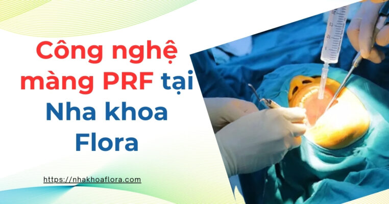 Công nghệ màng PRF