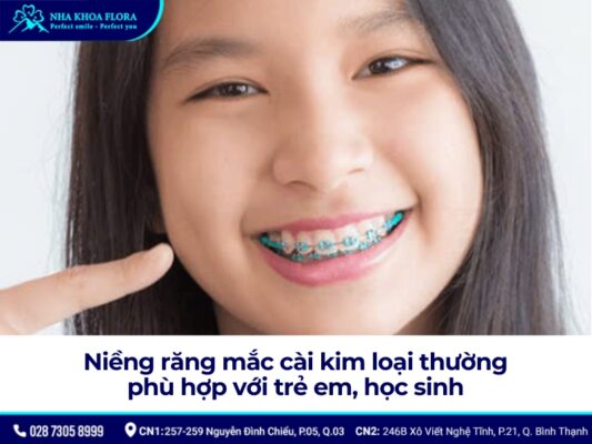 niềng răng mắc cài - ảnh 6