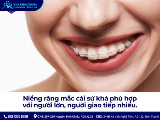 niềng răng mắc cài - ảnh 7