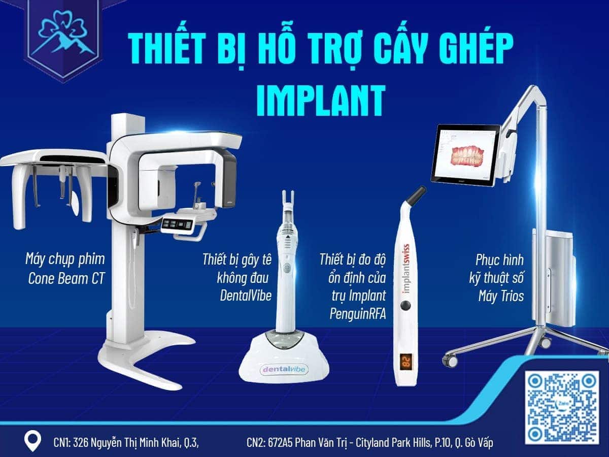 CHI PHÍ TRỒNG RĂNG IMPLANT TẠI NHA KHOA FLORA CẬP NHẬT 2025 5